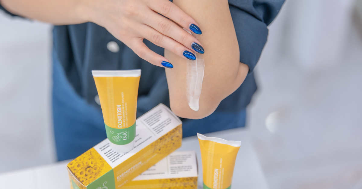 Allergisk eksem och kontaktdermatit – naturlig hudvård med InaEssentials