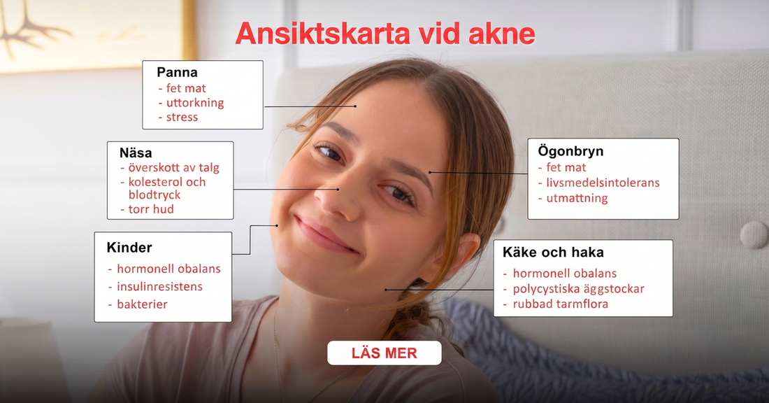 Ansiktskarta vid akne - se vilka zoner som visar obalanser