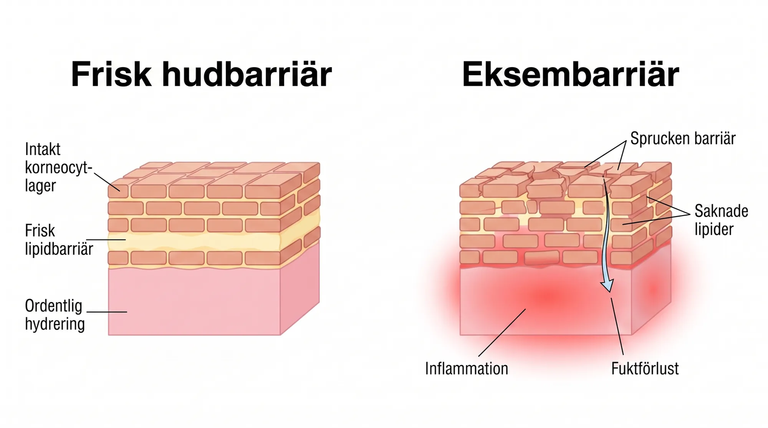 eczema_SE_skin_barrier_v2.png