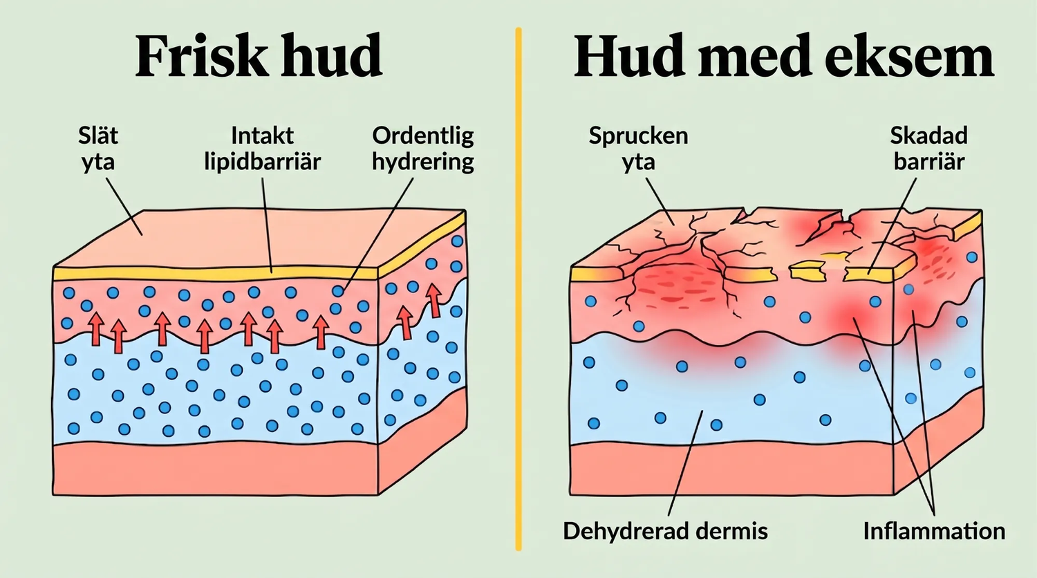 eczema_SE_skin_layers_v2.png