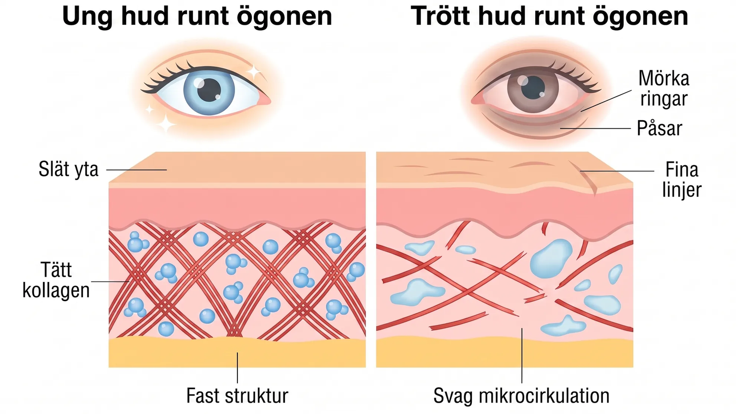 Rose Eye Lift SE eyev1