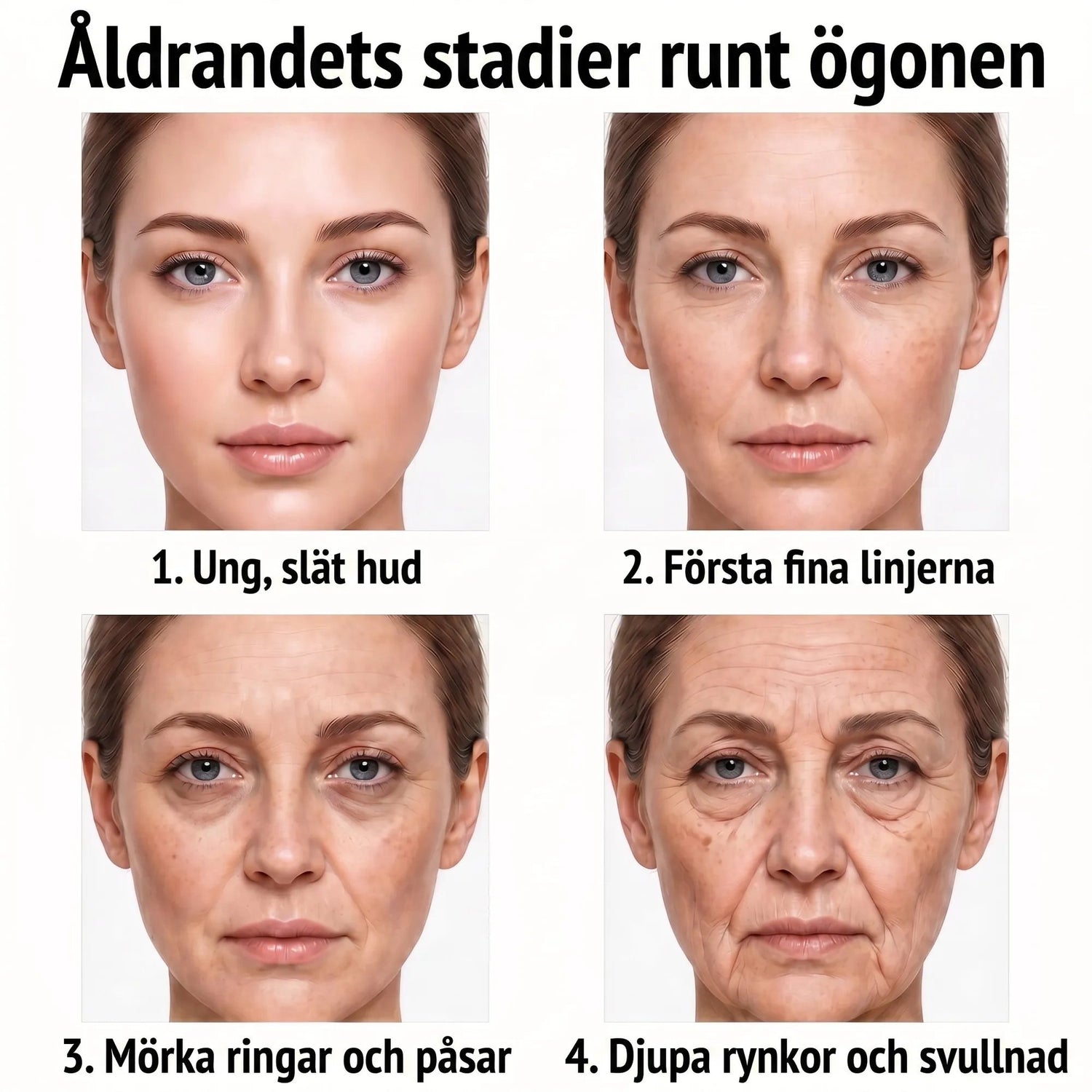Rose Eye Lift SE t15