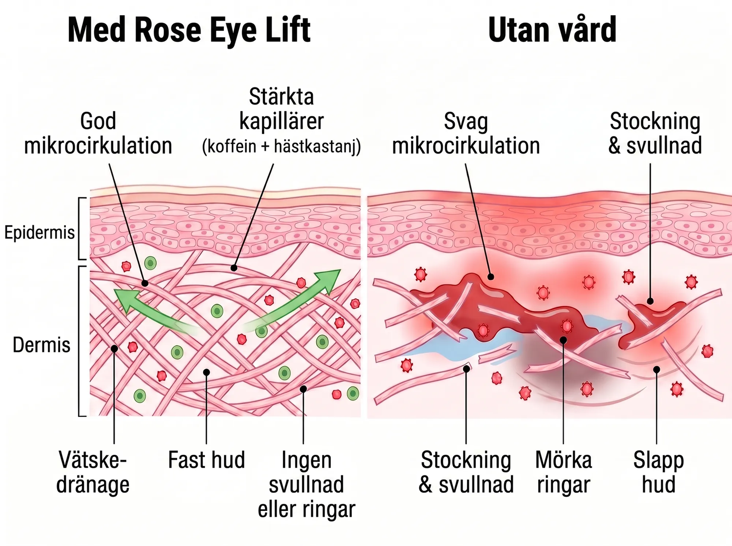 Rose Eye Lift SE t17