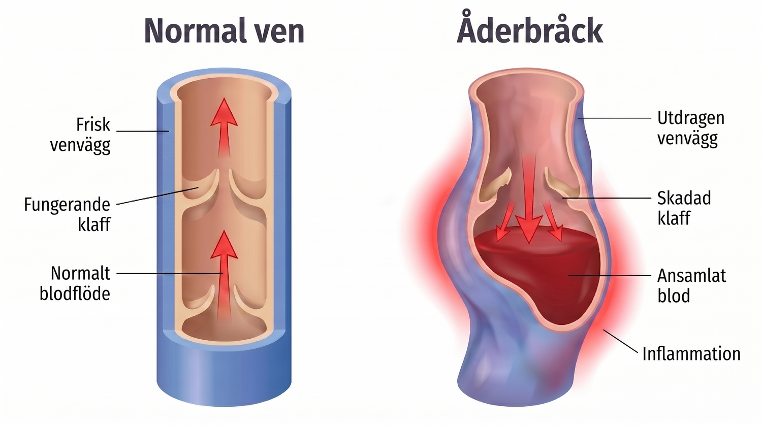 Vein anatomy diagram